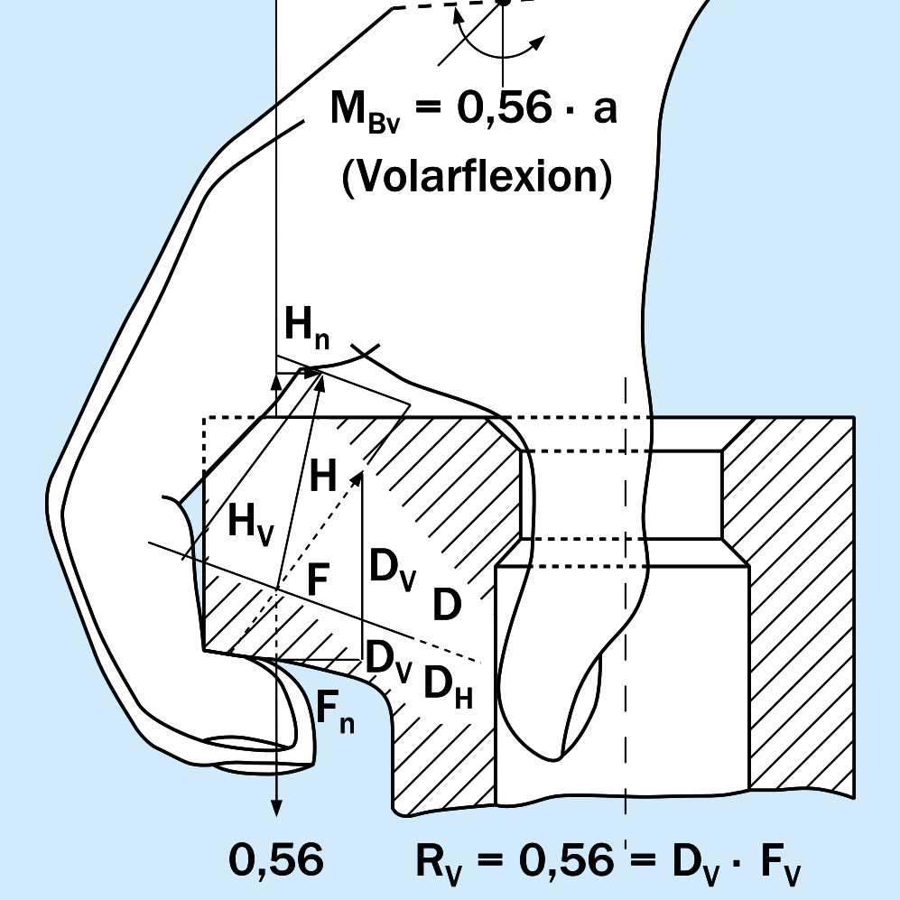Schematische Darstellung einer optimierten Griffhilfe bei einem mittelformatigen Kalksandstein